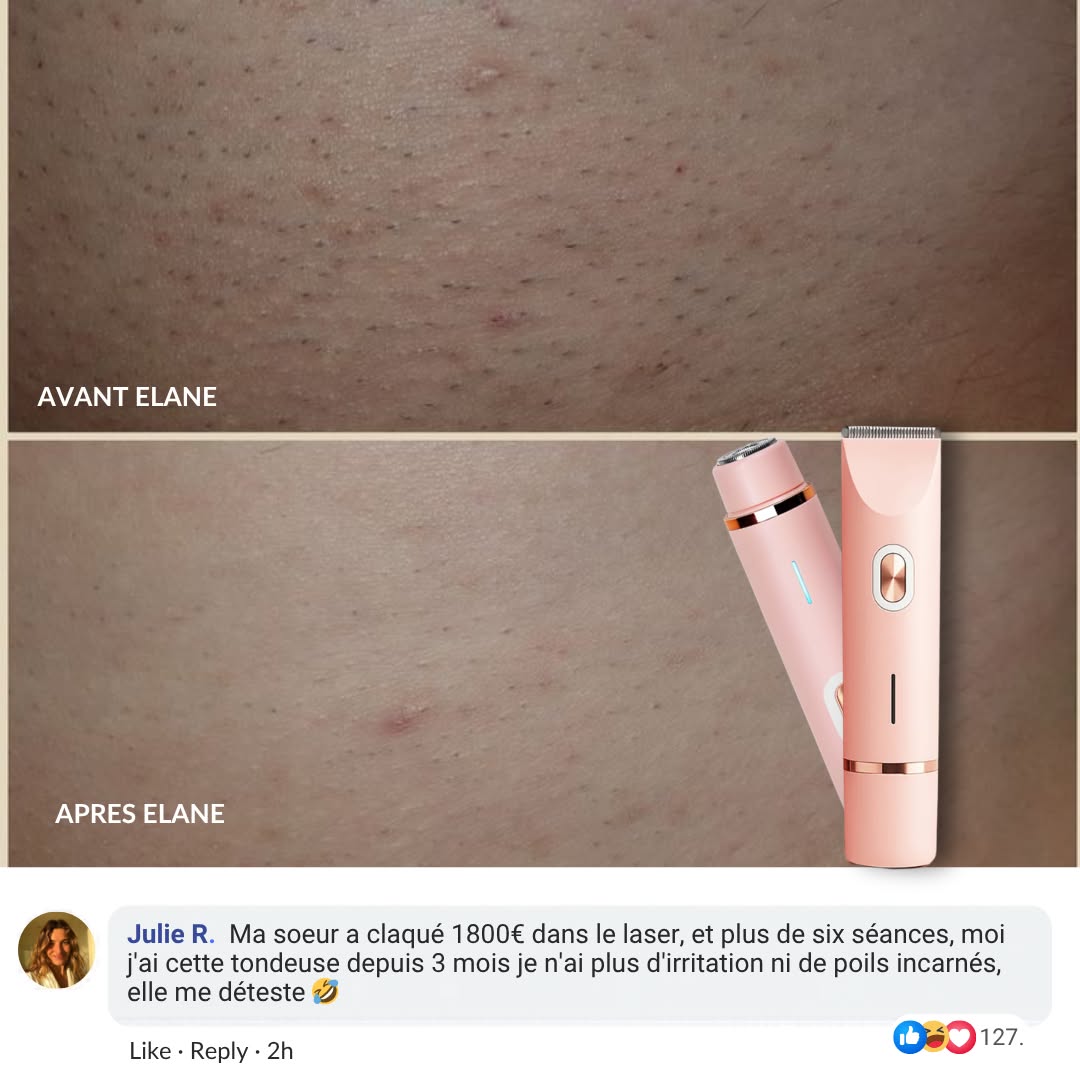 Élane before and after ad